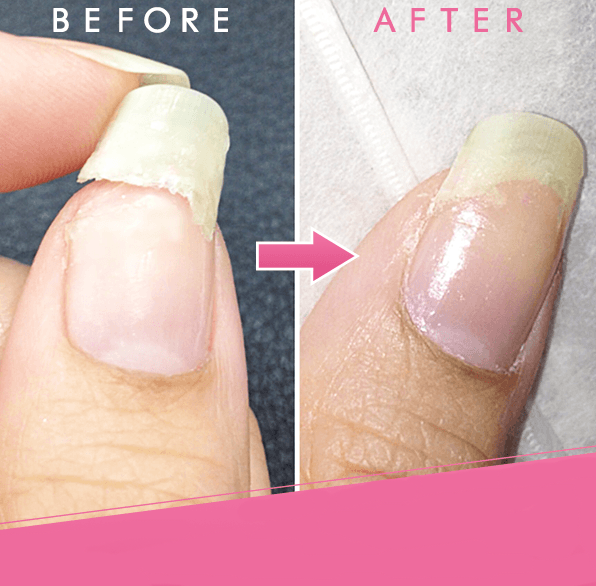 Nail Rescue Repair Gel | Instant Nail Repair & Long-Lasting Shine